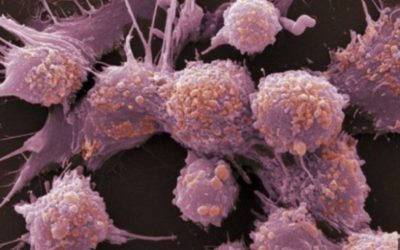 อะไรนะ! มะเร็งคือการปรับตัวของเซล